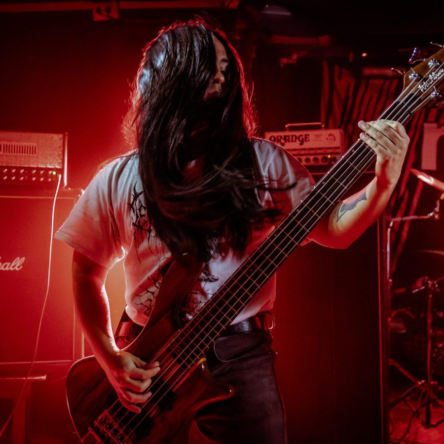 HALLUXVALGUS_22112024002