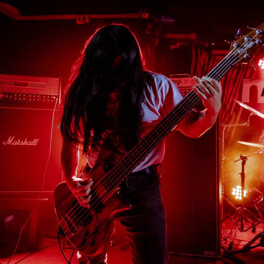 HALLUXVALGUS_22112024006