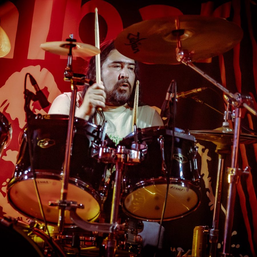 HALLUXVALGUS_22112024017