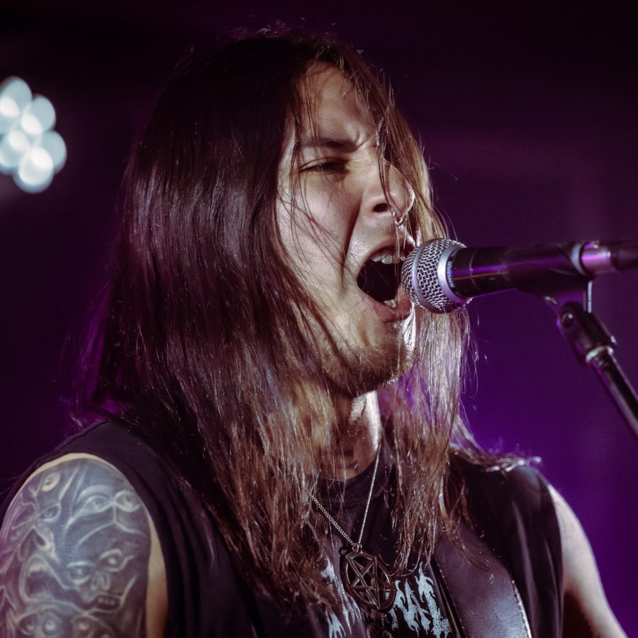 HALLUXVALGUS_22112024020