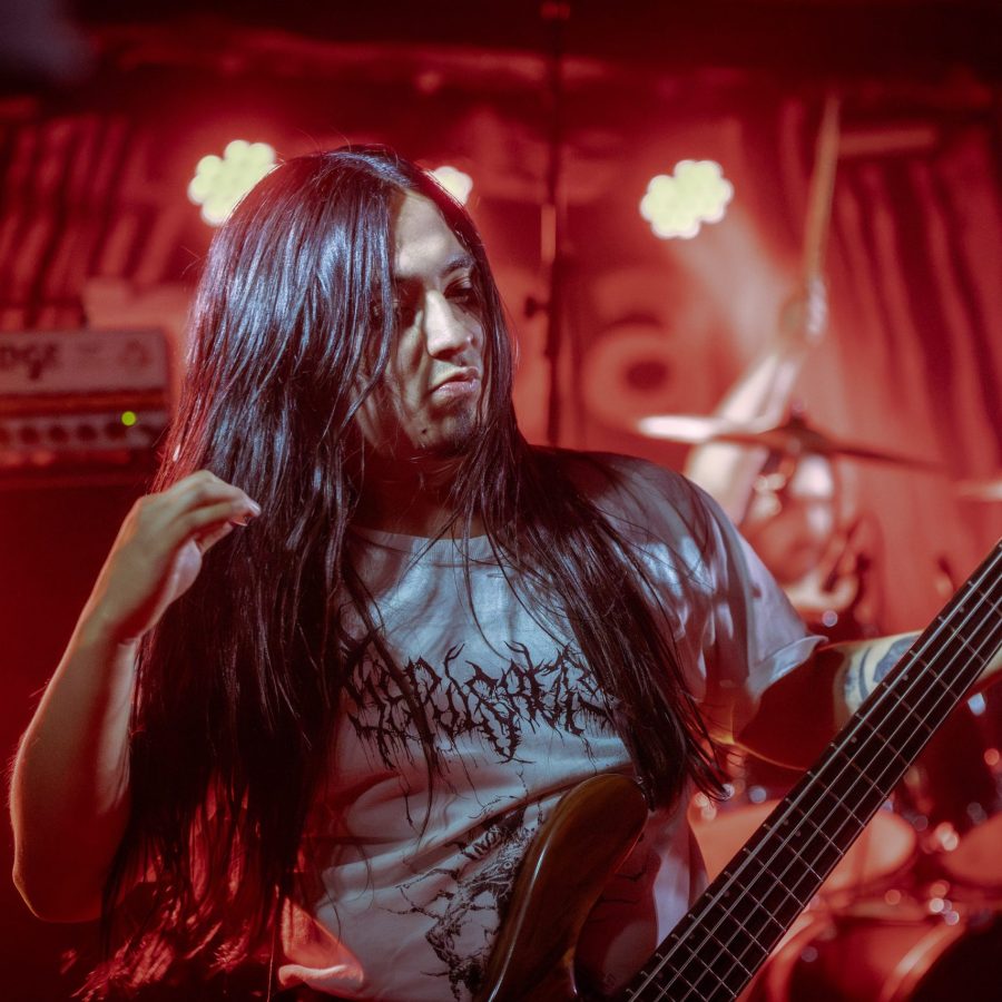 HALLUXVALGUS_22112024024