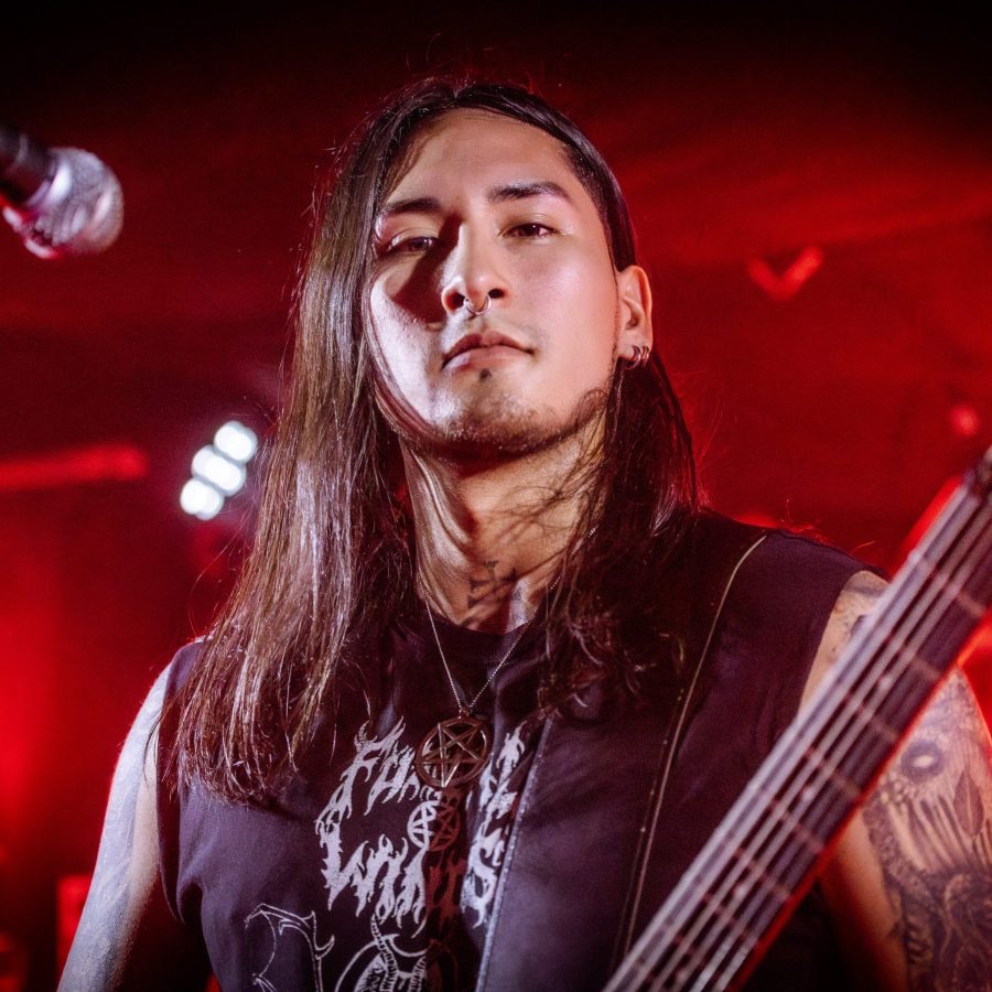 HALLUXVALGUS_22112024031