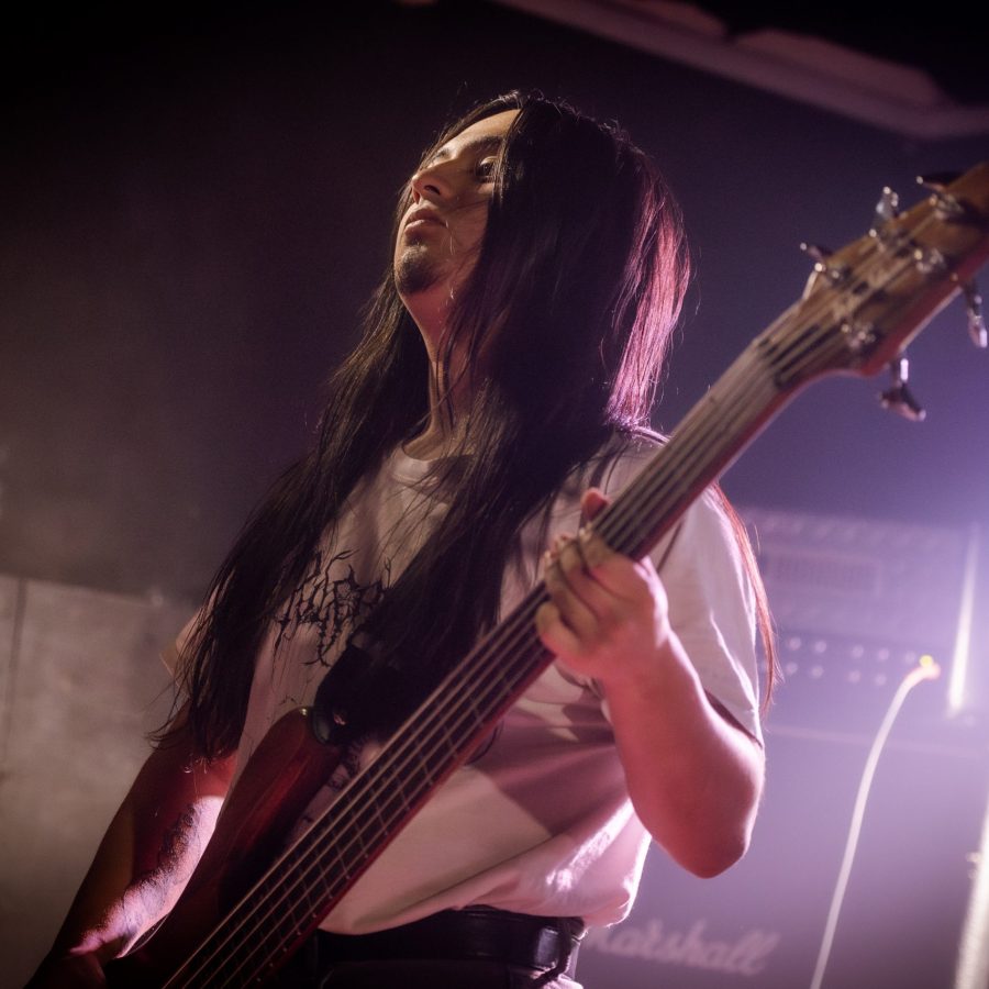 HALLUXVALGUS_22112024038