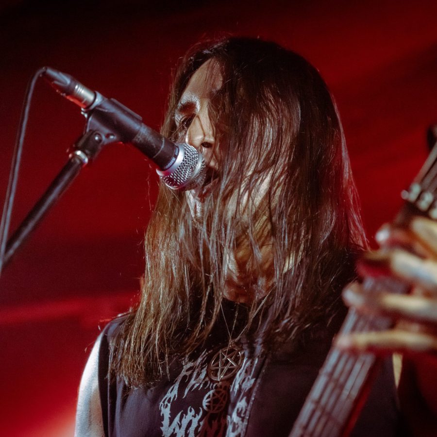 HALLUXVALGUS_22112024042